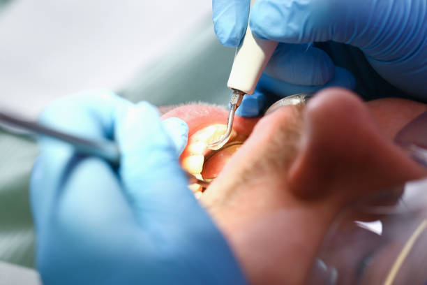 Best Emergency Dental Extractions in Munhall, PA